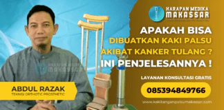Apakah Bisa Dibuatkan Kaki Palsu Akibat Kanker Tulang? Inilah Penjelasannya! Apa Bisa Di Buatkan Kaki Palsu Akibat Kanker Tulang ? Ini Penjelasannya !