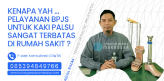 KENAPA Yah… PELAYANAN BPJS UNTUK KAKI PALSU SANGAT TERBATAS DI RUMAH SAKIT ? BPJS Kesehatan dan Pelayanan Kaki Palsu