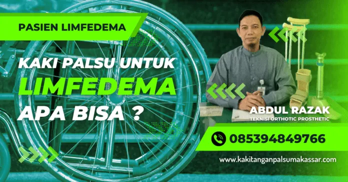 Pembuatan Kaki Palsu untuk Penderita Penyakit Limfedema Kaki Gajah, Apa Bisa menggunakan kaki palsu saat melakukan latihan rehabilitasi untuk mengatasi limfedema yang disebabkan oleh kaki gajah