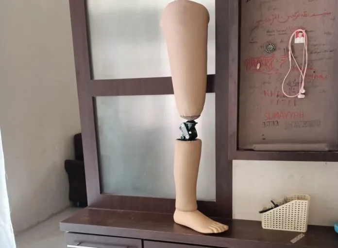 Kaki palsu atas lutut bantu Anda kembali berjalan & beraktivitas! Pelajari fungsinya, cara memilih, & tips perawatan. Tingkatkan mobilitas & kemandirian Anda.