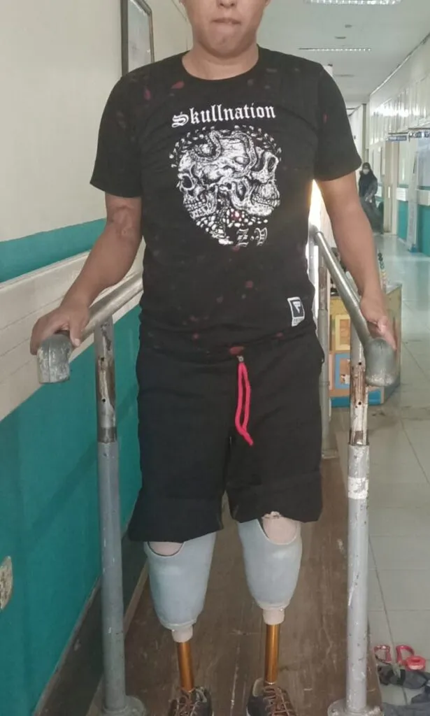 berjalan dengan kaki palsu