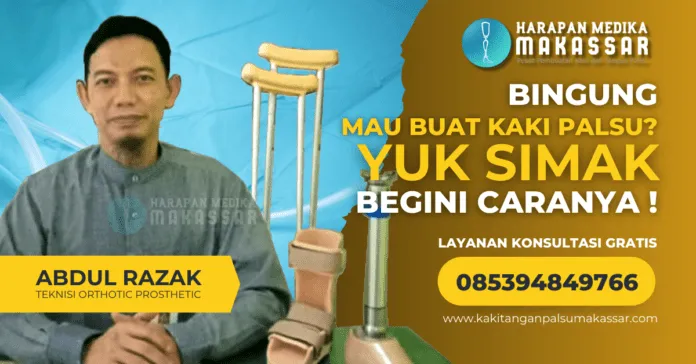 Bingung Mau Membuat Kaki Palsu? Yuk Simak, Begini Caranya!