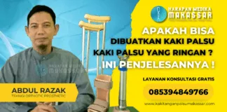 Cara Membuat Kaki Palsu yang Ringan dan Nyaman Dengan Harga Terjangkau Kaki Palsu Ringan: Solusi Terbaik untuk Pasien Amputasi di Indonesia