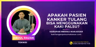 Apakah Pasien Kanker Tulang Bisa Menggunakan Kaki Palsu? Apakah Anda tahu bahwa kaki palsu bisa menjadi solusi bagi pasien kanker tulang yang harus menjalani amputasi? Cari tahu proses dan pentingnya asesmen medis di sini!