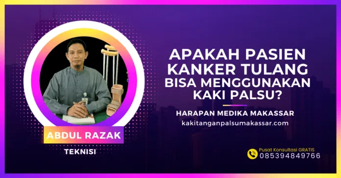Apakah Anda tahu bahwa kaki palsu bisa menjadi solusi bagi pasien kanker tulang yang harus menjalani amputasi? Cari tahu proses dan pentingnya asesmen medis di sini!