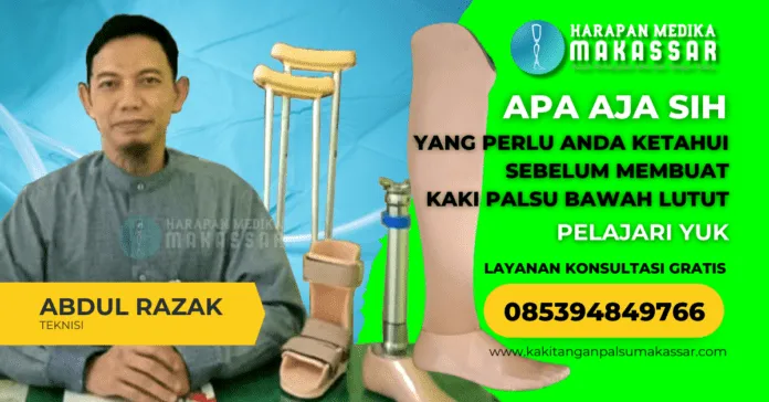 YANG PERLU ANDA KETAHUI SEBELUM MEMBUAT KAKI PALSU BAWAH LUTUT Tahukah Anda? Salah memilih waktu pengukuran kaki palsu bisa membuatnya tidak nyaman. Simak tipsnya di sini!