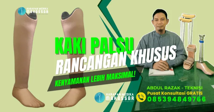 KAKI PALSU BAWAH LUTUT HARGA TERJANGKAU LEBIH NYAMAN DI GUNAKAN Kaki palsu tanpa sabuk, lebih nyaman untuk aktivitas harian! Melangkah stabil tanpa ribet, solusi modern untuk amputasi bawah lutut! Bebas bergerak, kaki palsu bawah lutut terbaik untuk Anda! Hidup baru dimulai dengan langkah yang lebih percaya diri! Rasakan teknologi kaki palsu modern, nyaman dan simpel digunakan! Prostetik tanpa sabuk, langkah ringan untuk hari yang ceria! Solusi prostetik canggih, mobilitas maksimal tanpa batas! Desain inovatif, nyaman dipakai, cocok untuk kebutuhan Anda! Langkah pasti, nyaman, dan stabil dengan kaki palsu modern! Kembali aktif dengan kaki palsu yang dirancang khusus untuk Anda!