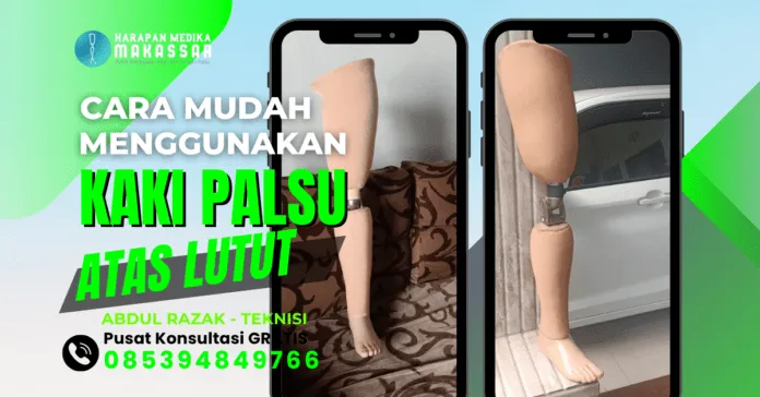 Temukan Cara Optimal Menggunakan Kaki Palsu Atas Lutut di Sini!