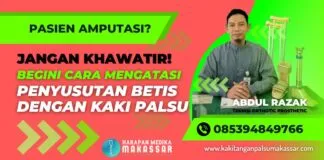 Apakah Memang Perlu Kaos Kaki untuk Lapisan Soket Kaki Palsu? Pakai Kaki Palsu? Begini Trik Supaya Selalu Nyaman Seharian Tanpa Keluhan