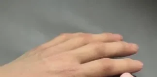 Anda Membutuhkan Jari Palsu? Pahami Lebih Dalam Sebelum Memutuskan! Pembuatan Jari Palsu Terbaik di Makassar | KakitanganPalsuMakassar