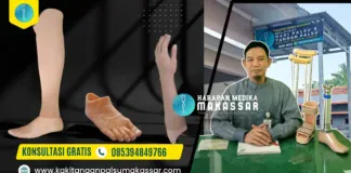 Layanan Pembuatan Kaki Palsu dan Tangan Palsu di Palu dan Gorontalo dari Harapan Medika Makassar Pembuatan Kaki Palsu dan Tangan Palsu di Palu Gorontalo