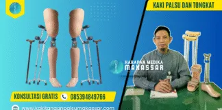 APA BENAR, PASIEN PAKE KAKI PALSU WAJIB LEPAS TONGKAT? Ini Penjelasannya Kaki Palsu dan Tongkat