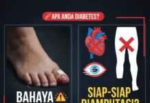 APAKAH ANDA DIABETES? KENALI RESIKO YANG BISA TERJADI resiko-komplikasi-diabetes