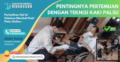 Perhatikan Hal Ini Sebelum Membeli Kaki Palsu Online