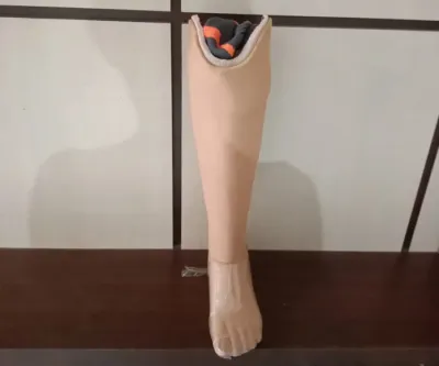 Pusat Pembuatan Kaki Palsu dan Tangan Palsu Dengan Harga Terjangkau Ini Penyebab & Cara Mengatasi Pincang Saat Menggunakan Kaki Palsu