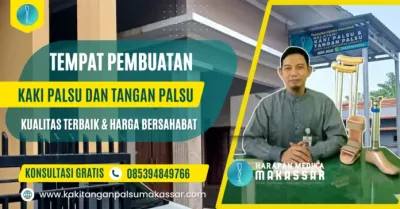 Kaki-Palsu-dan-Tangan-Palsu-Berkualitas-untuk-Wilayah-Indonesia-Timur Kaki & Tangan Palsu Berkualitas untuk Wilayah Indonesia Timur