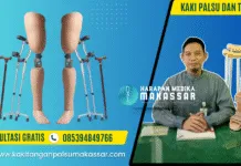 APA BENAR, PASIEN PAKE KAKI PALSU WAJIB LEPAS TONGKAT? Ini Penjelasannya Kaki Palsu dan Tongkat