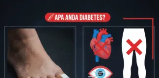 APAKAH ANDA DIABETES? KENALI RESIKO YANG BISA TERJADI resiko-komplikasi-diabetes